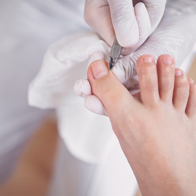 professional-medical-pedicure-procedure-close-up-using-nail-clippers